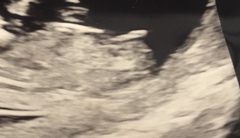 Nub theory - predictions!