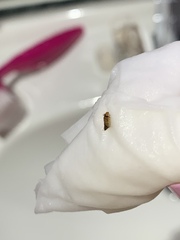 Bugs after peeing! Help please!