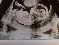 Boy or girl?