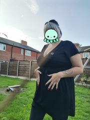 I've had a gastric sleeve!