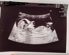 April 2022 Birth Club