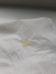 Is this part of my mucus plug???