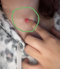 Can a viral infection cause pain further down the throat?