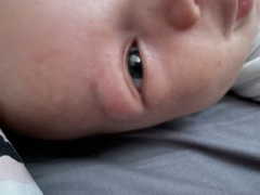 Useless Doctors, please help!! 7 week baby’s eye!!