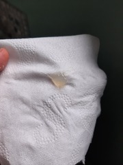 Is this part of my mucus plug???