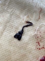 WARNING GRAPIC PICS  (miscarriage pics/bloods clots?)