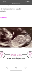Nub theory - sex of the baby guesses?