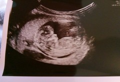 Boy or girl?