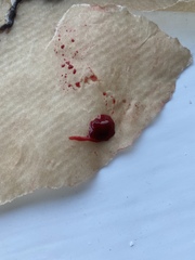 WARNING GRAPIC PICS  (miscarriage pics/bloods clots?)