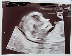 April 2022 Birth Club