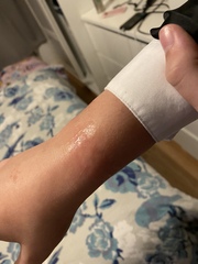 How to treat this?