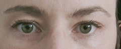 If you had an Upper Blepharoplasty