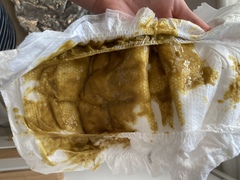 Is this normal baby poo (TMI warning photo attached)