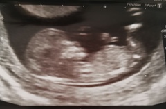 Another gender prediction....