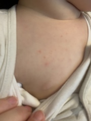 Dr says rash is just viral but not sure.. (pic)