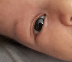 Useless Doctors, please help!! 7 week baby’s eye!!