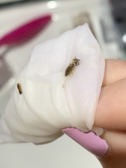 Bugs after peeing! Help please!