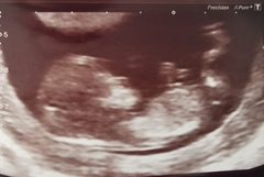 Another gender prediction....