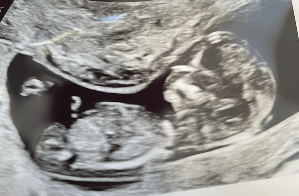 🤰🏾Due May 2022🤰🏾