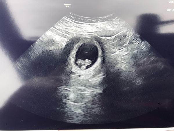 Due June 2022 (thread four)