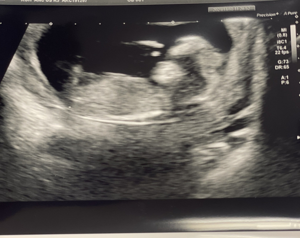 Any gender guesses ? Nub