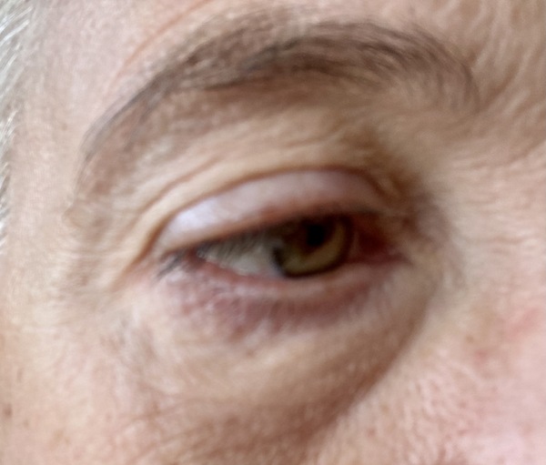 Eye advice needed