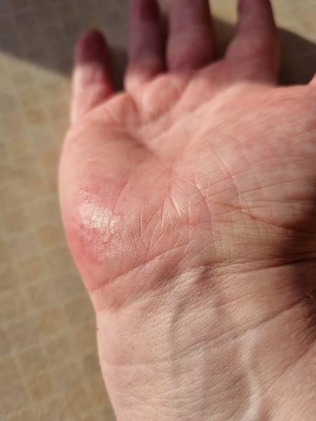Is this  phomplox  execma  ? ( pic )