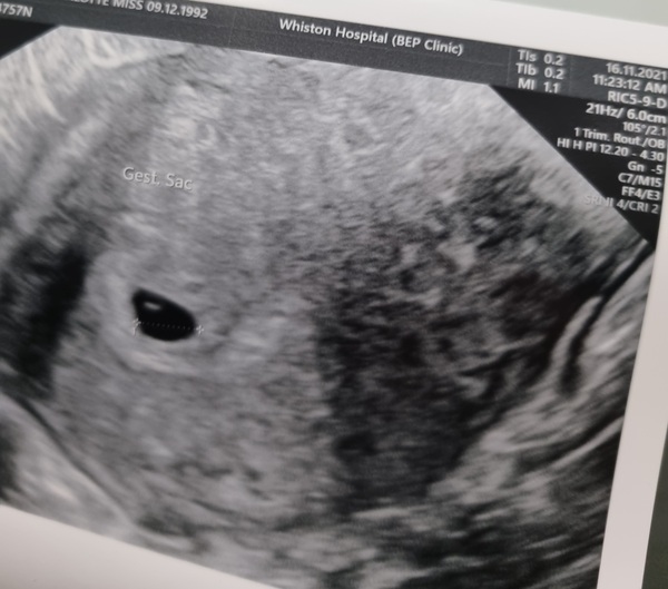 Tracking your cycle and possible BFP using RHR - part 6