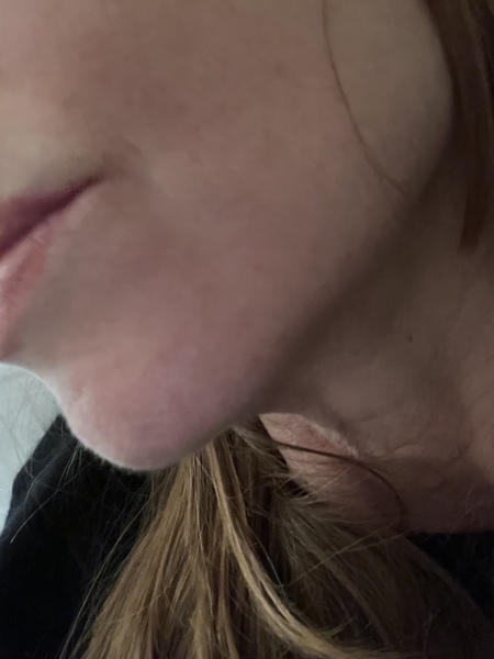 Does the Foreo Bear work?