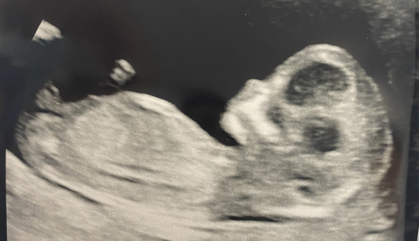 Due May 2022 (thread 3)