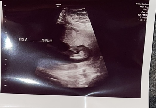 Nub theory any guesses boy or girl??