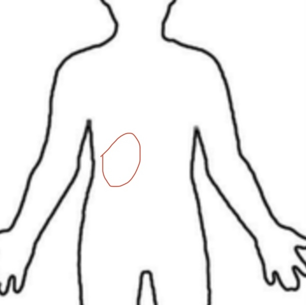 Does this look like the shingles rash?
