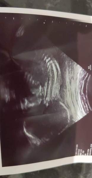 Due March / April 2022 2nd thread 2nd trimester