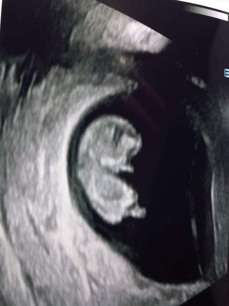 Does this 9w 6d scan look OK?