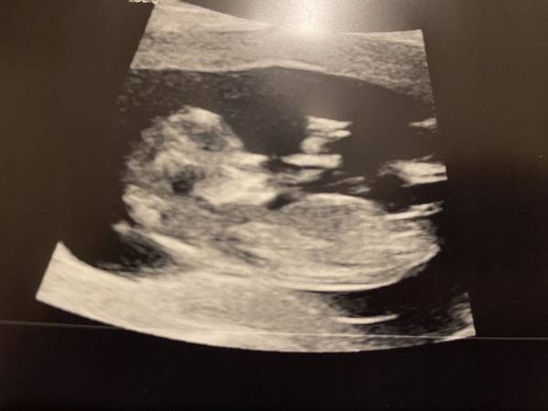 Due June 2022 (thread four)
