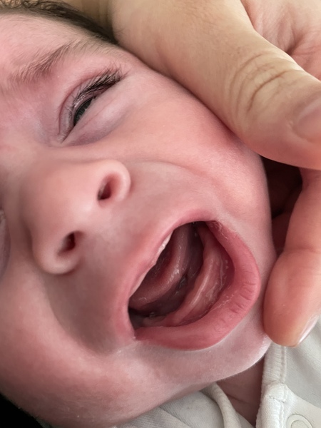 Does this look like teething?