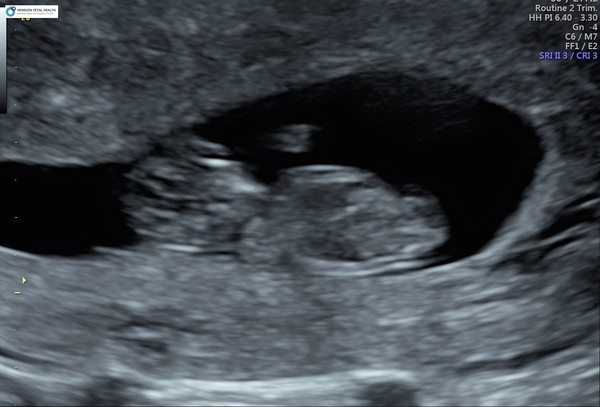 Due June 2022 (thread four)