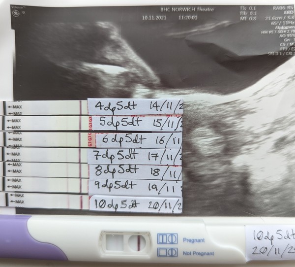 IVF/FET October/November 21 part 2