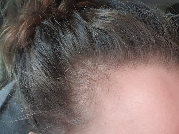 Hair Colour Help