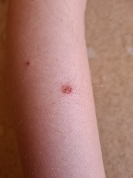DD's skin not healing