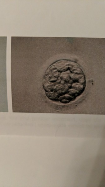 IVF/FET October/November 21