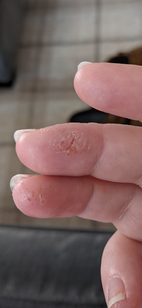 Sore Fingers - Help Please (Pic Inside)