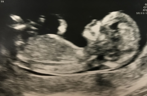 Gender guesses please! 😁