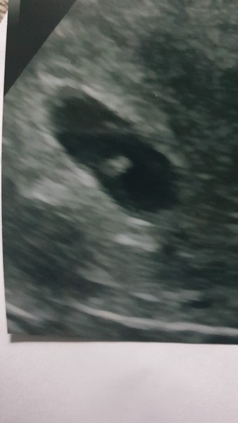 Due July 2022 (thread 2)