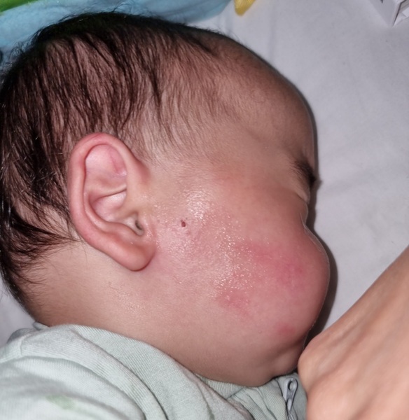 Heath Issue toddler