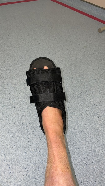 The world's most ugly shoes?