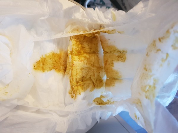 a little bit of blood in my baby's poo! (Picture of dirty nappy included)