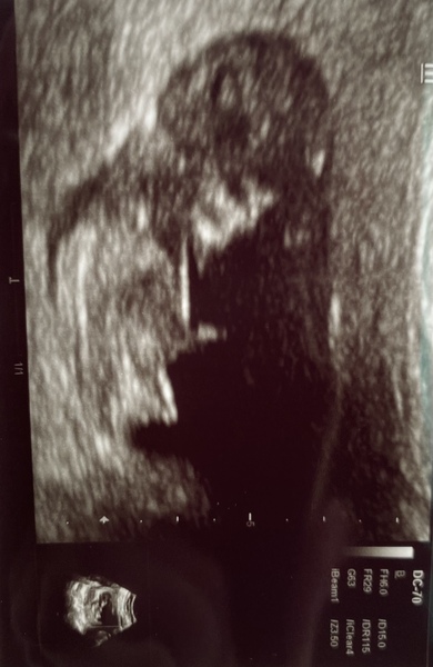 Due June 2022 (thread four)