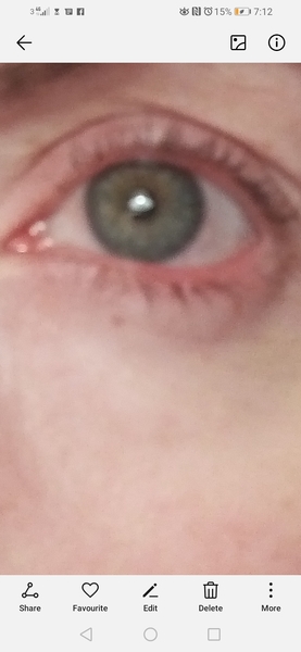 To ask what could be wrong with my eyes?