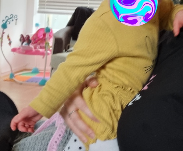 'Skydiving' arms all of the time in 8.5 month old.